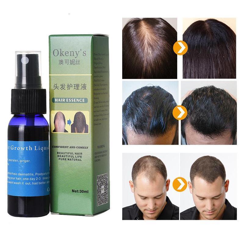 Sunburst Hair Growth spray