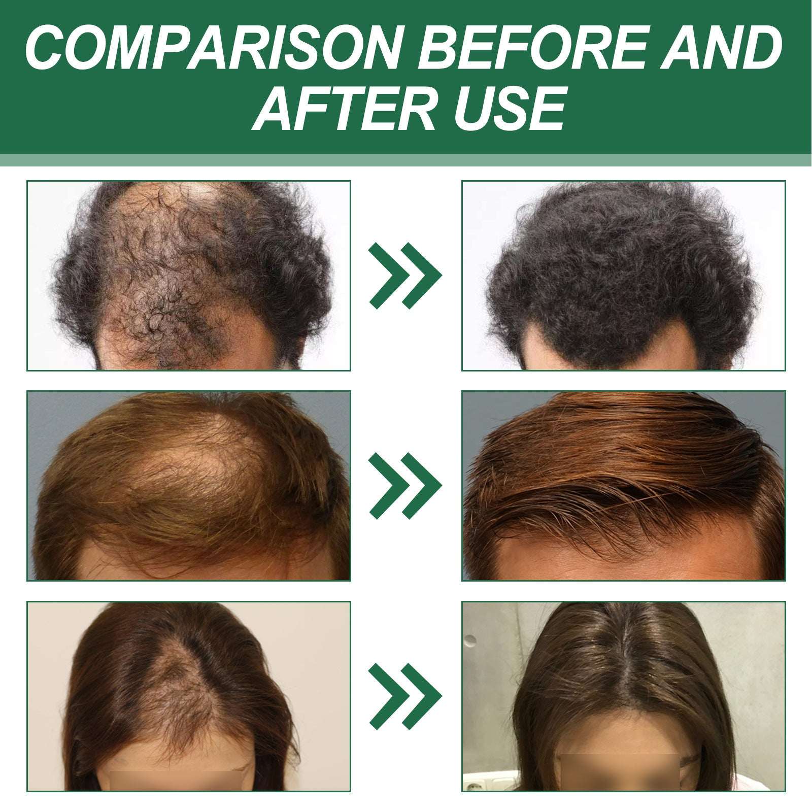 Anti-hair Red Ginseng Hair Spray