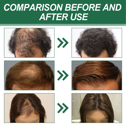 Anti-hair Red Ginseng Hair Spray