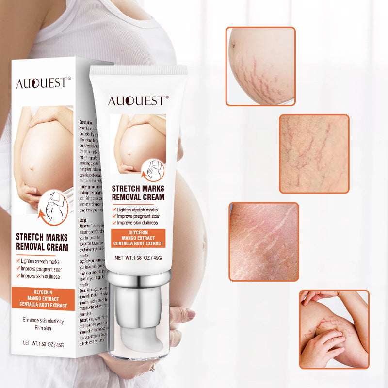 Remove Pregnancy Scars Acne Cream