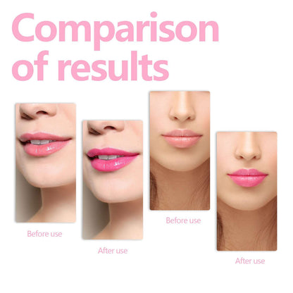 Moisturizing Lip Care Oil