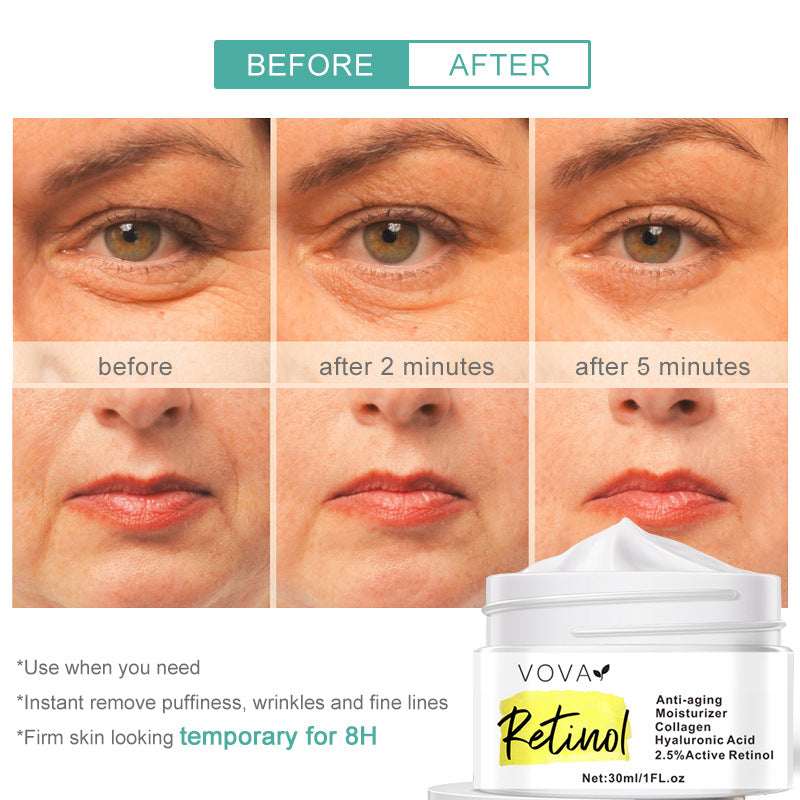 RETINOL ANTI-AGING MOISTURIZER FACE CREAM - 30ML